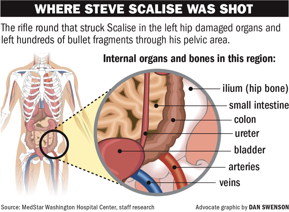 061717 Scalise Hip Shot.jpg